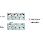 PLASTİK RÖTRE NEDİR?